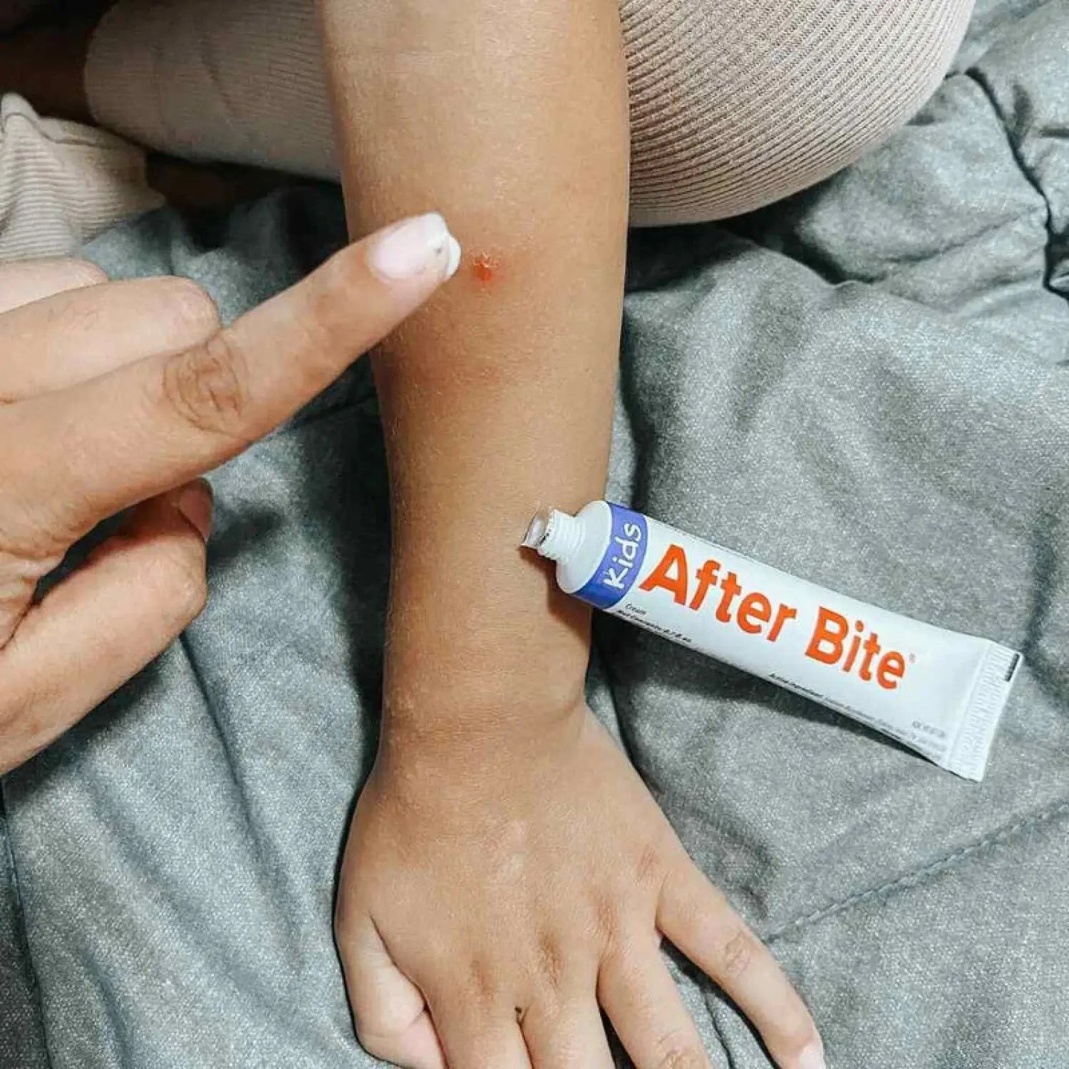 After Bite Kids Bug Bite Itch Relief, lifestyle view